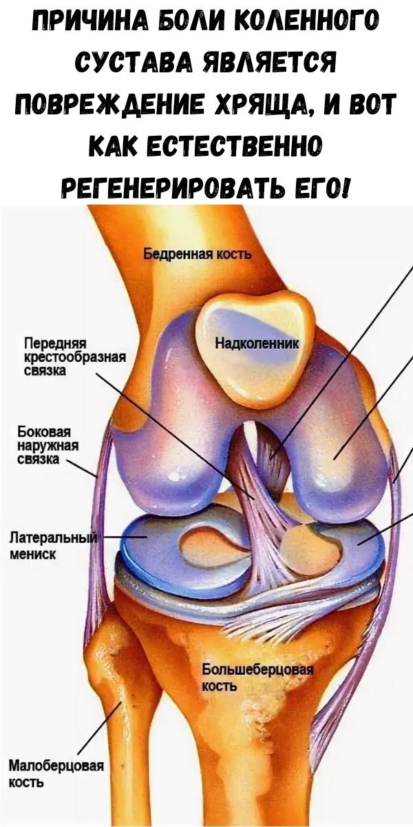 Причина боли коленного сустава является повреждение хряща, и вот как естественно регенерировать его!