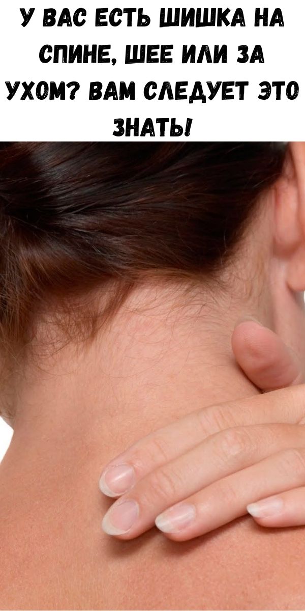 У Вас есть шишка на спине, шее или за ухом? Вам следует это знать!