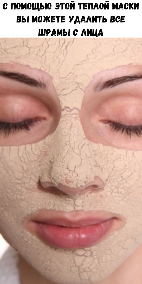 С помощью этой теплой маски вы можете удалить все шрамы с лица