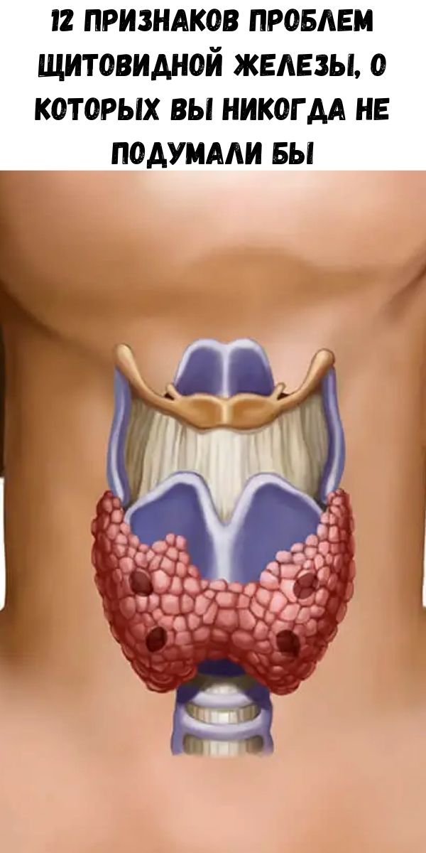 12 признаков проблем щитовидной железы, о которых вы никогда не подумали бы