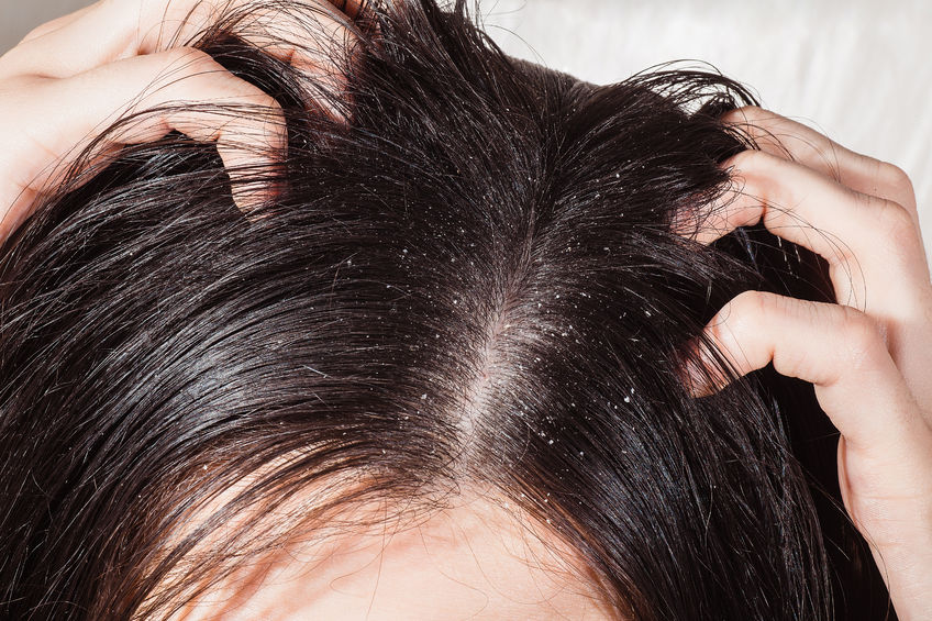 Как защитить волосы и кожу головы