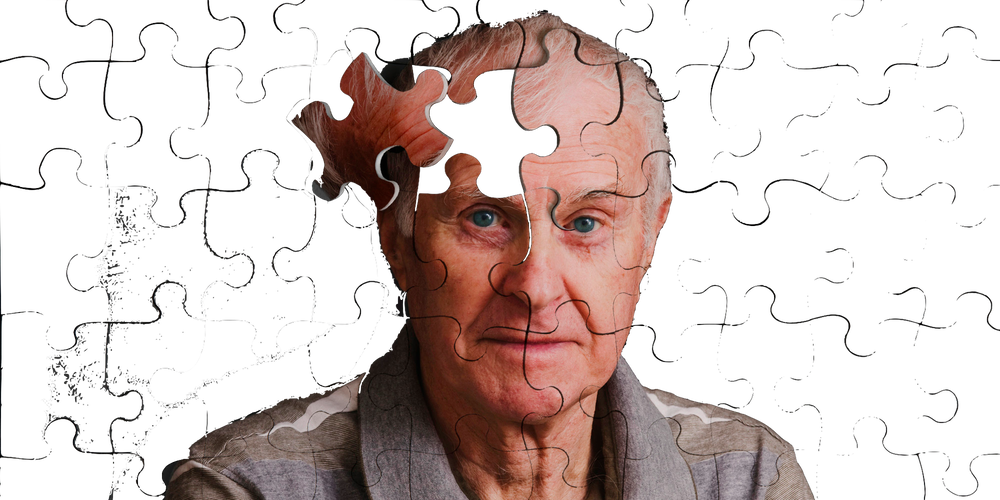 Разрушь память. Альцгеймеровское лицо. Мозг пожилых людей. Альцгеймера и Паркинсона. Болезнь Альцгеймера.