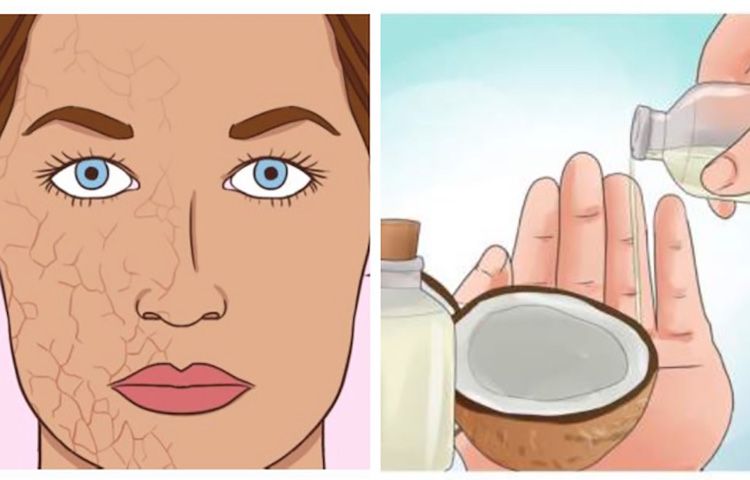 10 натуральных увлажняющих средств для лечения сухой кожи!