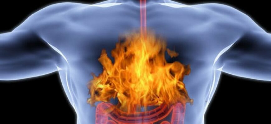 5 простых способов лечения изжоги естественным способом