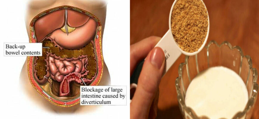 ПРОСТАЯ СМЕСЬ ДЛЯ ОЧИСТКИ ВАШЕГО КИШЕЧНИКА ВСЕГО ИЗ 2 ИНГРЕДИЕНТОВ
