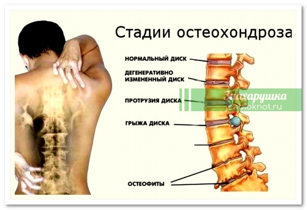 Сенсационная гимнастика Бутримова для шеи: нормализует кровообращение и положение позвонков