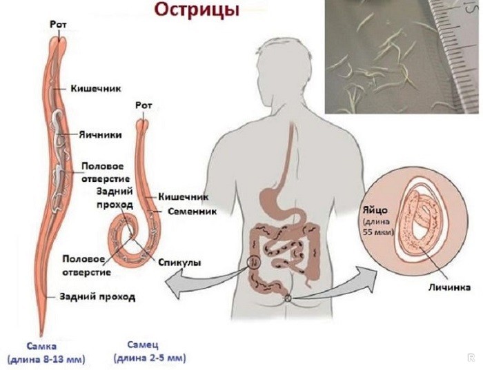 Скрытые симптомы, которые могут появиться у человека, зараженного глистами