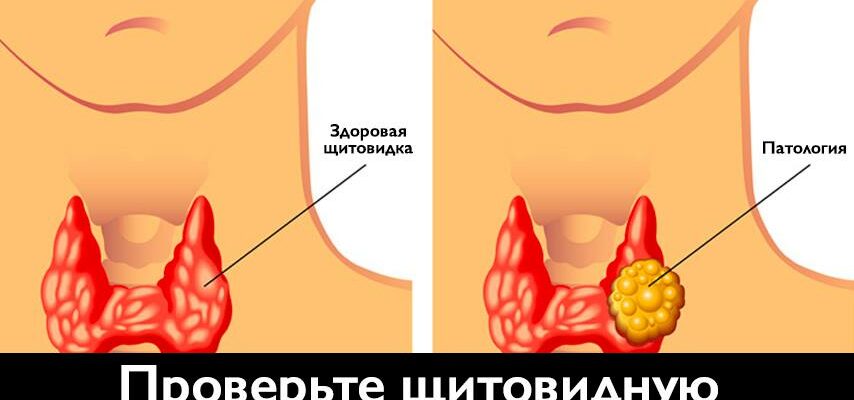 Проверьте щитовидную железу в домашних условиях с помощью этого простого теста!