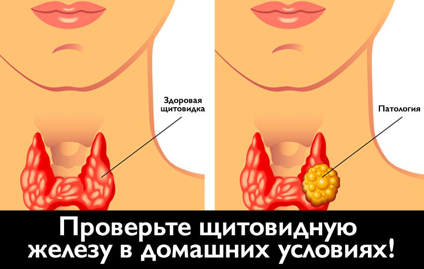 Проверьте щитовидную железу в домашних условиях с помощью этого простого теста!