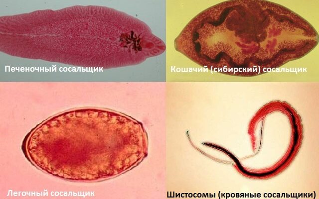 Избавьтесь от жира и уничтожьте всех паразитов из вашего организма с помощью этого ингредиента