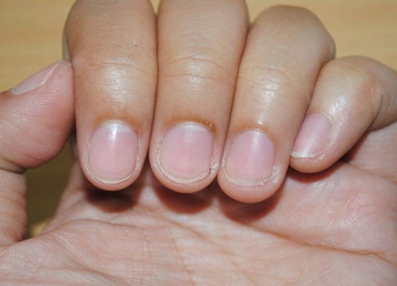 Почему ногти стали тоньше. Тонкие ногти. Нормальные ногти.